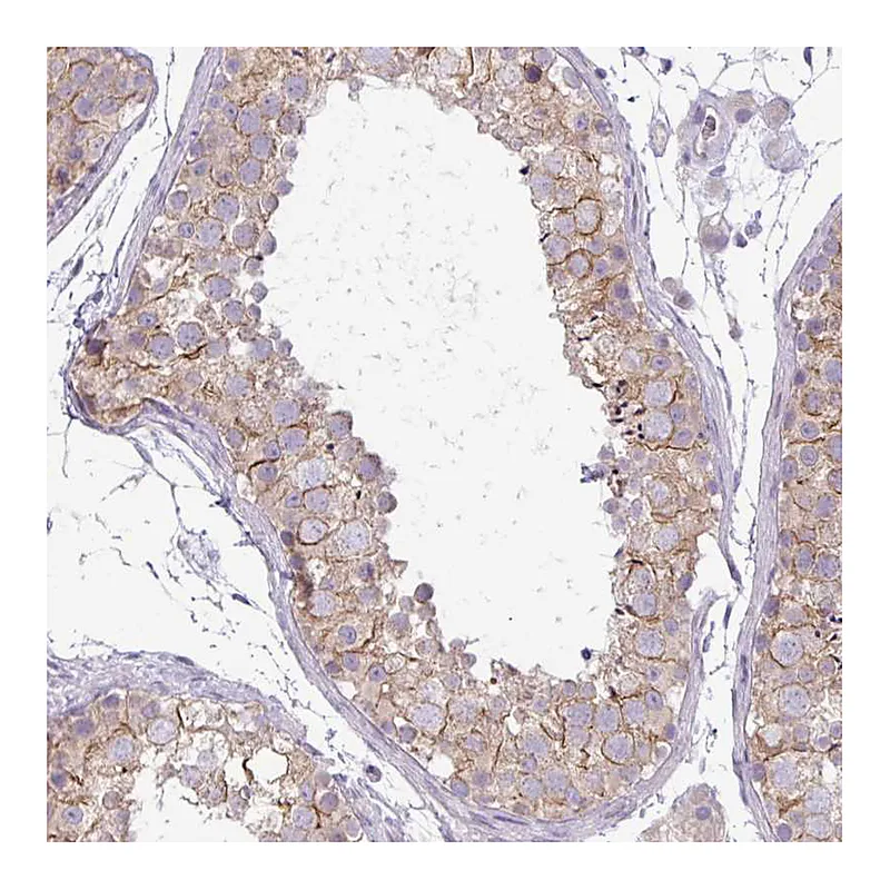Atlas Antibodies Anti-PNLDC1 Antibody