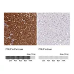 Atlas Antibodies Anti-PNLIP Antibody