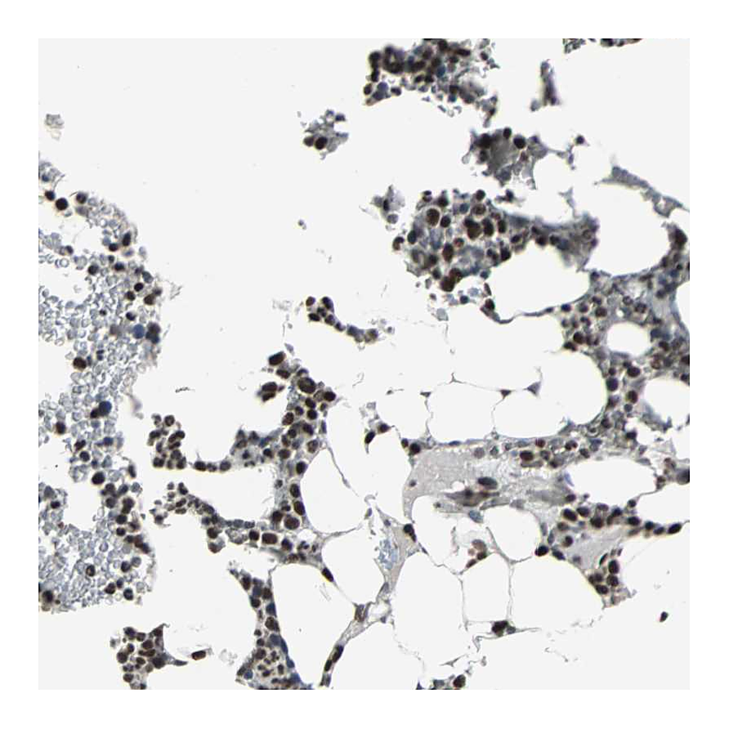 Atlas Antibodies Anti-PNKP Antibody