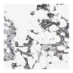 Atlas Antibodies Anti-PNKP Antibody