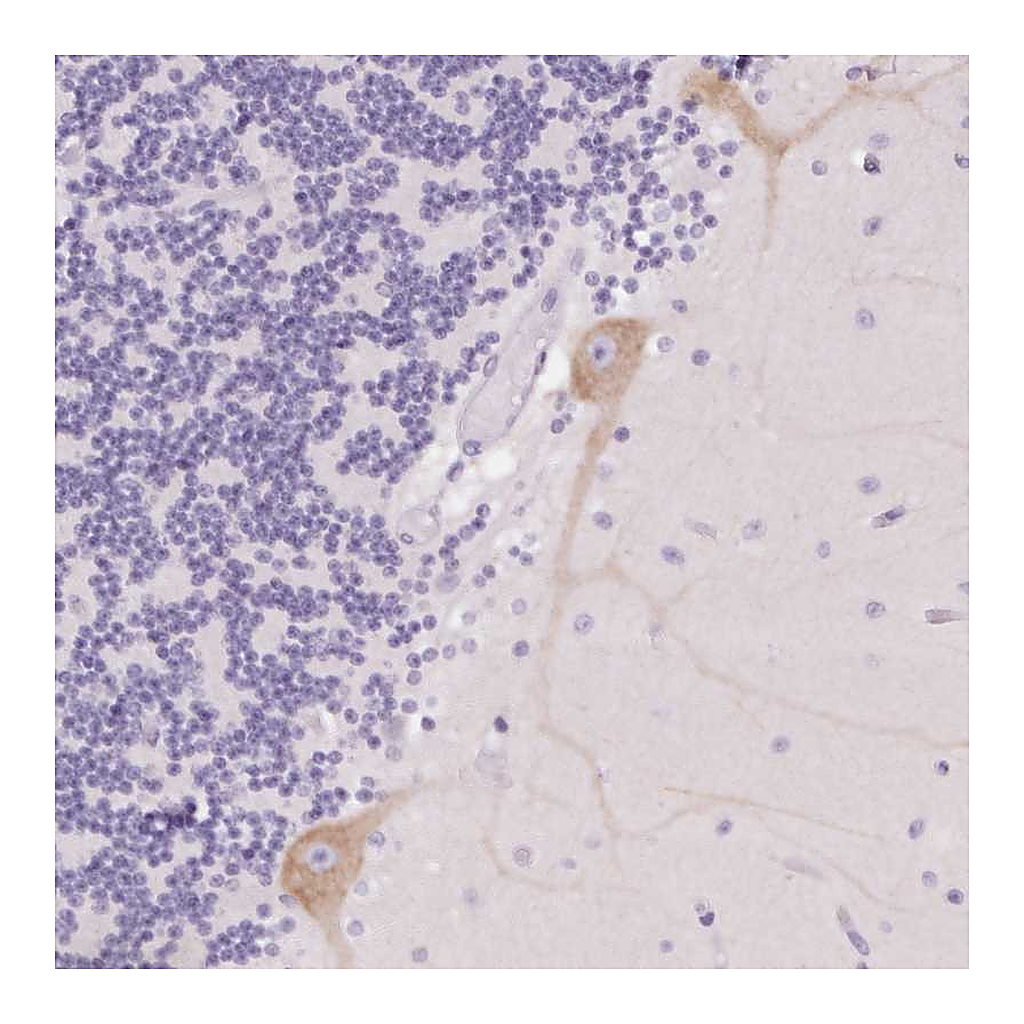 Atlas Antibodies Anti-PNLIPRP3 Antibody