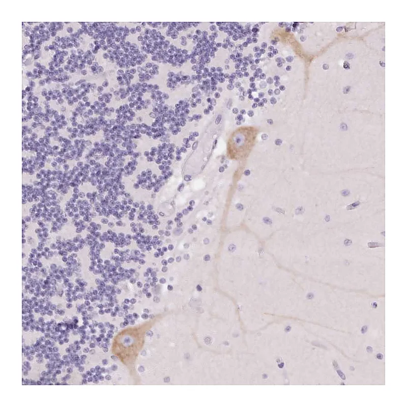 Atlas Antibodies Anti-PNLIPRP3 Antibody