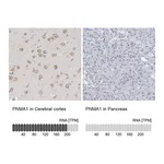 Atlas Antibodies Anti-PNMA1 Antibody