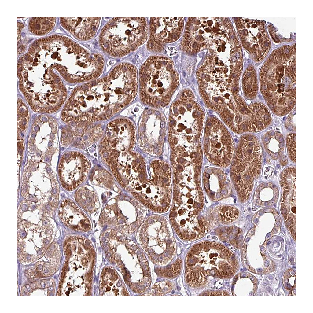 Atlas Antibodies Anti-PNMA6A Antibody