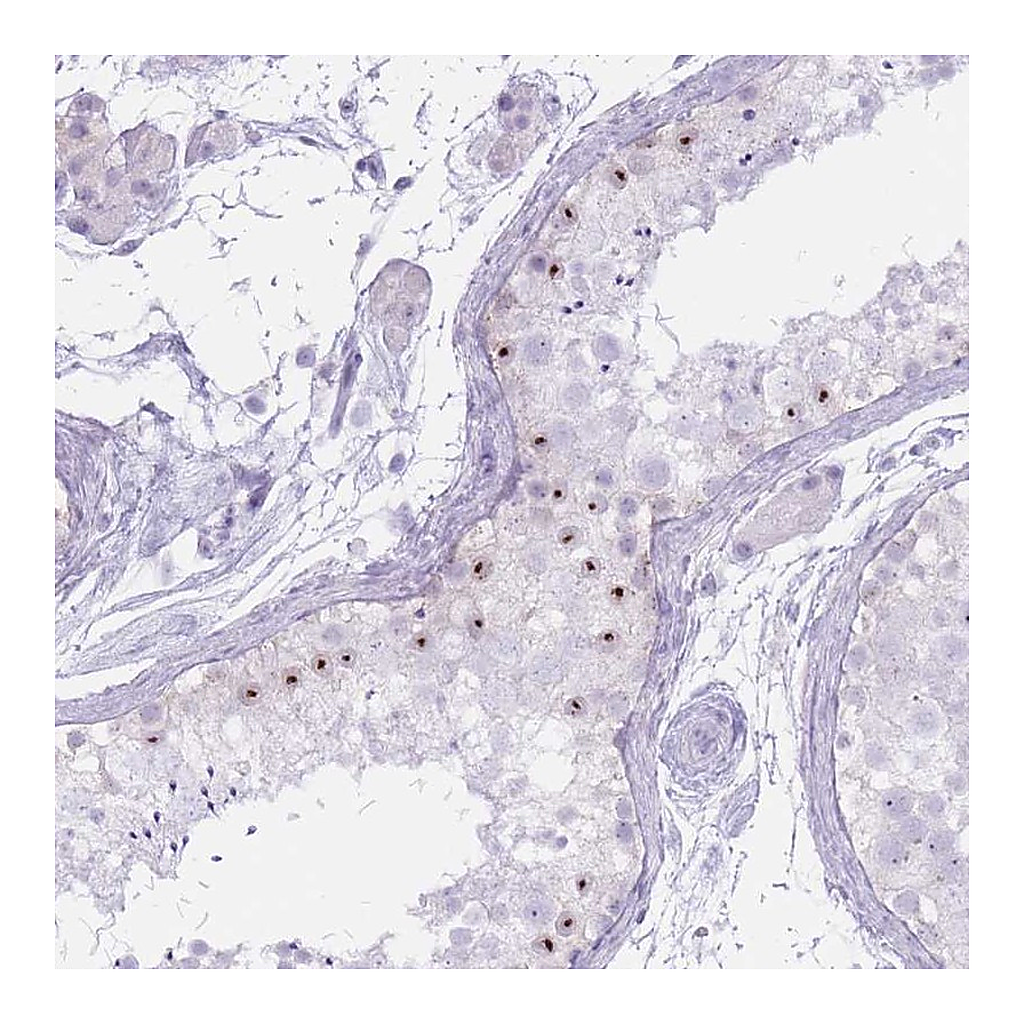 Atlas Antibodies Anti-PNMA3 Antibody