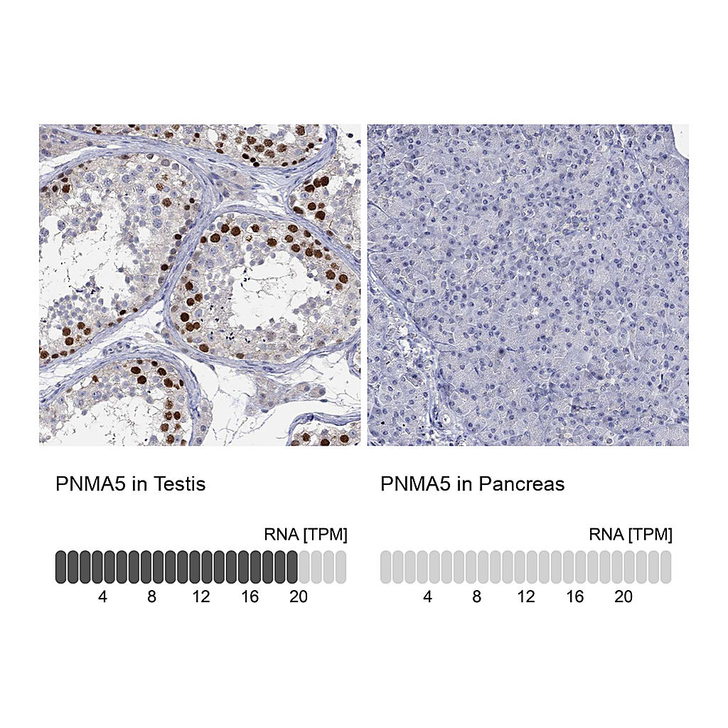Atlas Antibodies Anti-PNMA5 Antibody