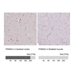Atlas Antibodies Anti-PNMA2 Antibody