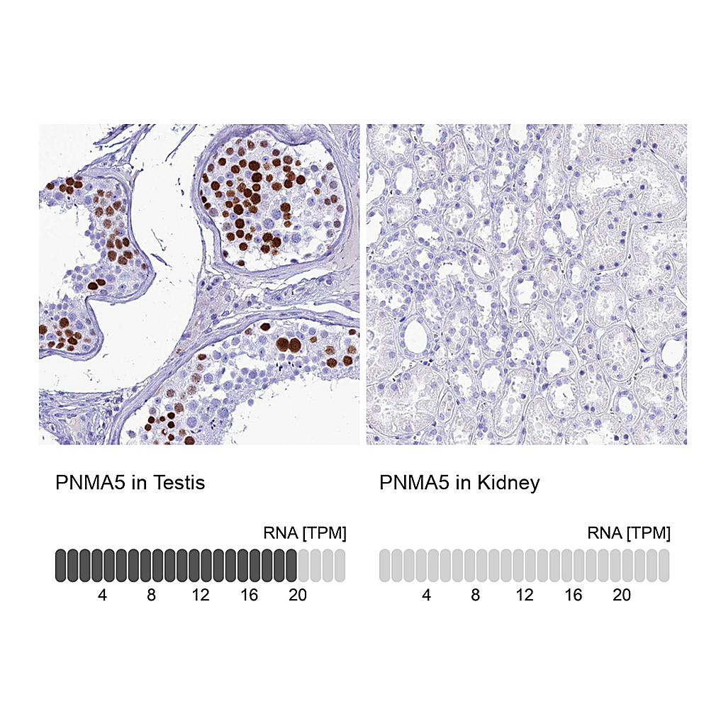 Atlas Antibodies Anti-PNMA5 Antibody