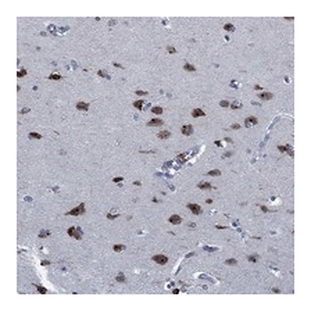 Atlas Antibodies Anti-PNMA8A Antibody