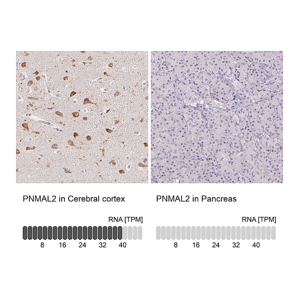 Atlas Antibodies Anti-PNMAL2 Antibody