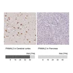 Atlas Antibodies Anti-PNMAL2 Antibody