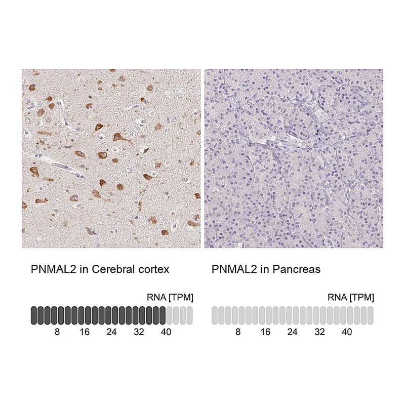 Atlas Antibodies Anti-PNMAL2 Antibody