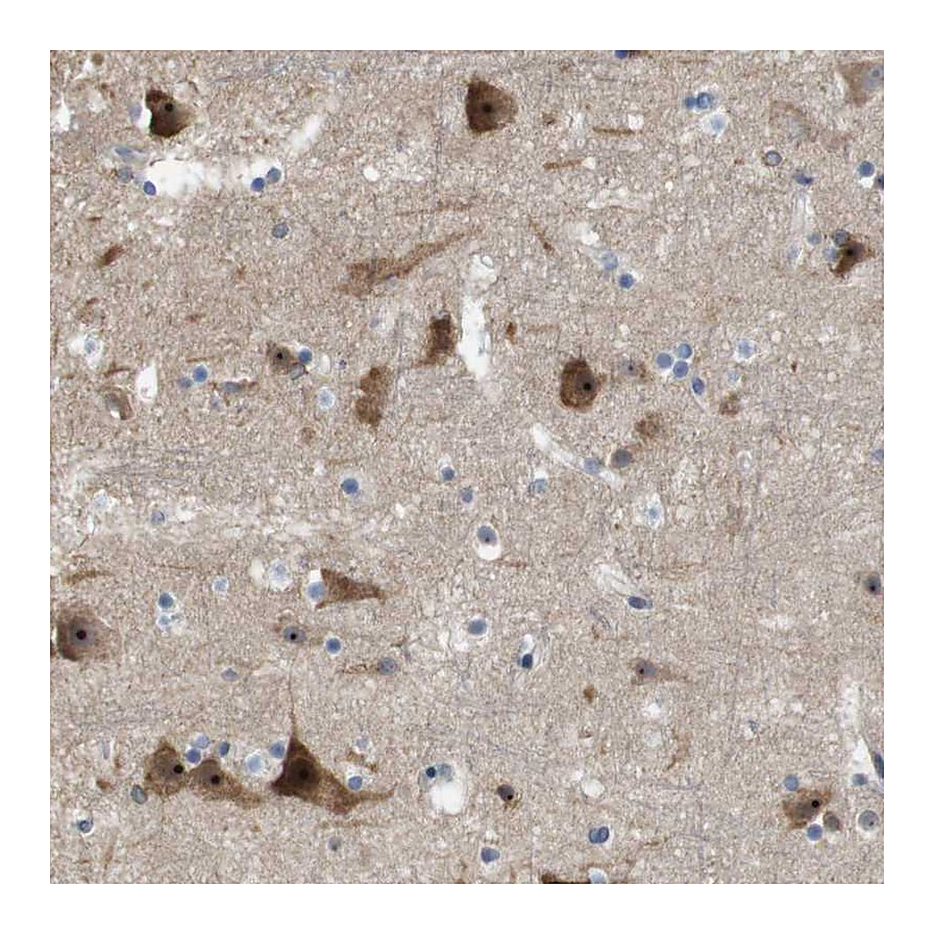 Atlas Antibodies Anti-PNMAL1 Antibody