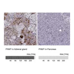 Atlas Antibodies Anti-PNMT Antibody