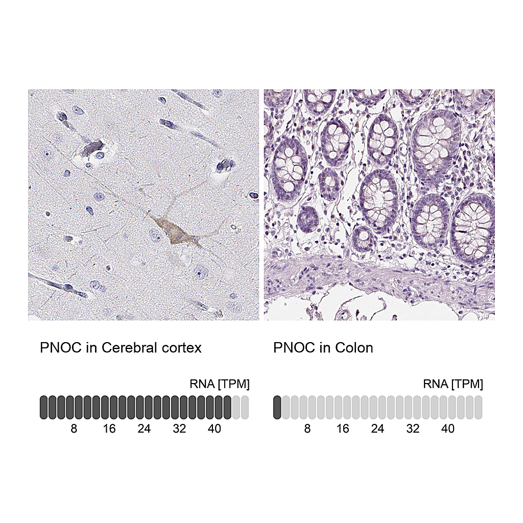 Atlas Antibodies Anti-PNOC Antibody