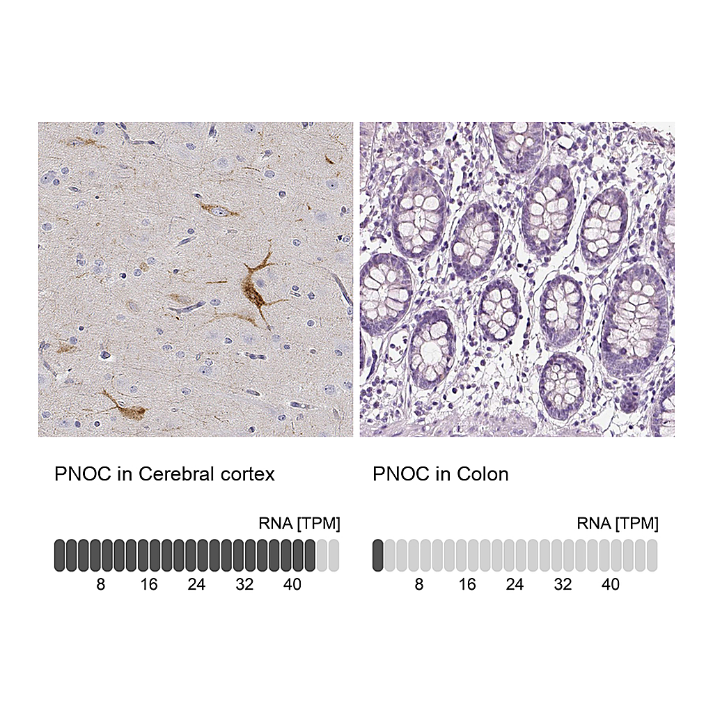 Atlas Antibodies Anti-PNOC Antibody