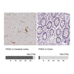 Atlas Antibodies Anti-PNOC Antibody