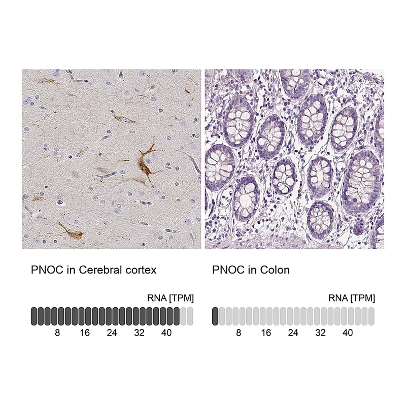 Atlas Antibodies Anti-PNOC Antibody
