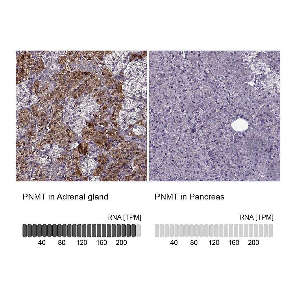 Atlas Antibodies Anti-PNMT Antibody