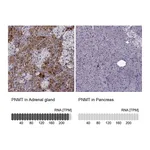 Atlas Antibodies Anti-PNMT Antibody
