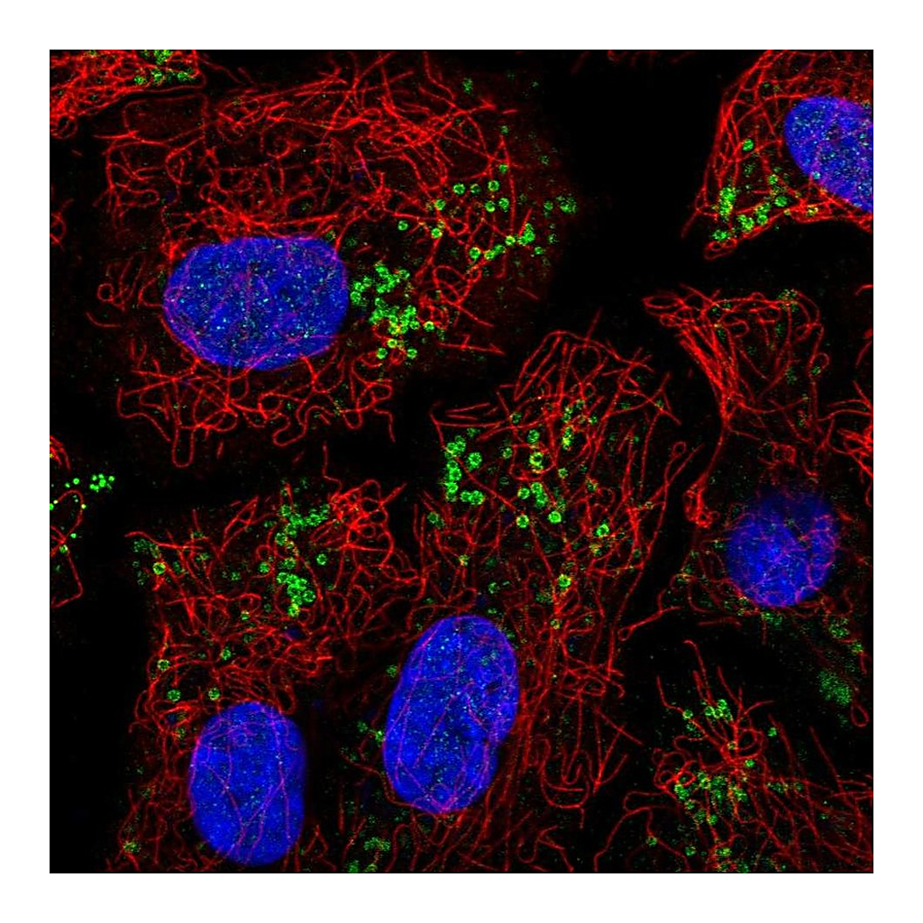 Atlas Antibodies Anti-PNPLA2 Antibody
