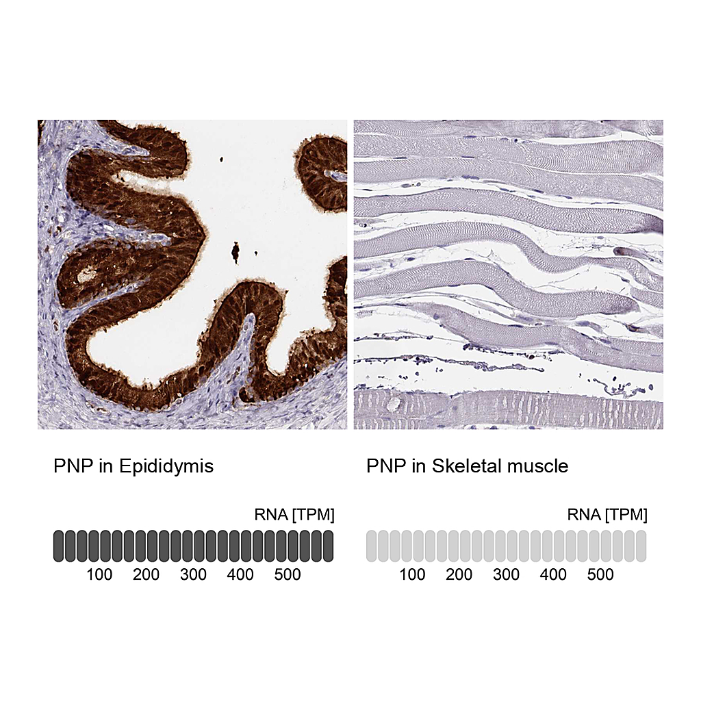 Atlas Antibodies Anti-PNP Antibody