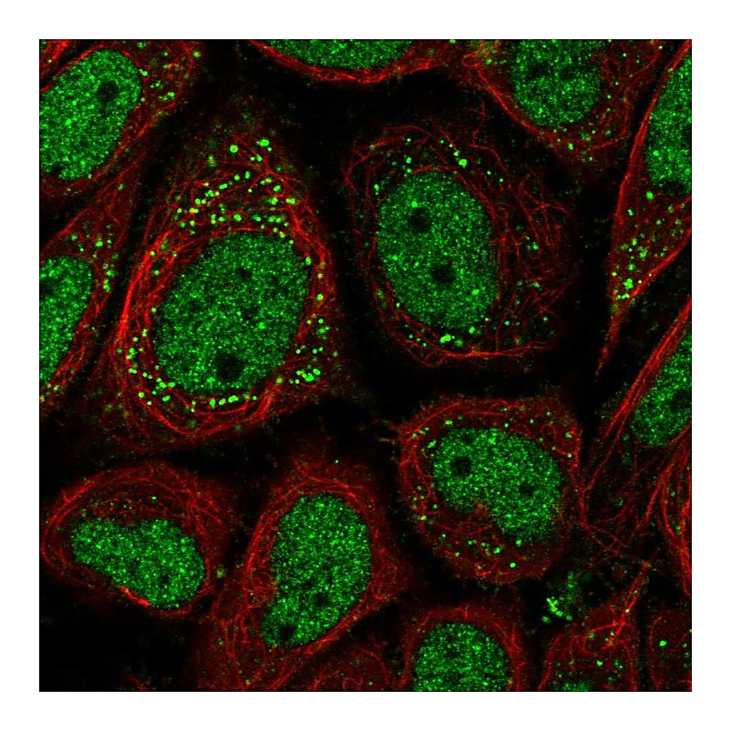 Atlas Antibodies Anti-PNPLA2 Antibody