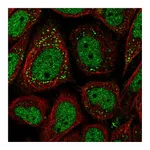 Atlas Antibodies Anti-PNPLA2 Antibody