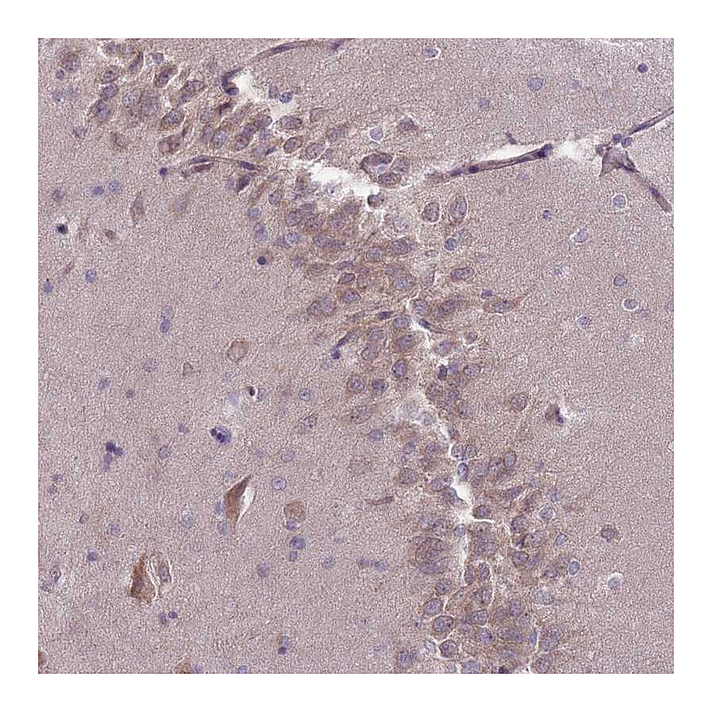 Atlas Antibodies Anti-PNPLA5 Antibody