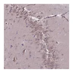 Atlas Antibodies Anti-PNPLA5 Antibody