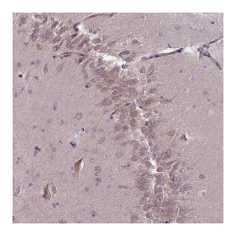 Atlas Antibodies Anti-PNPLA5 Antibody