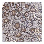 Atlas Antibodies Anti-PNPLA4 Antibody