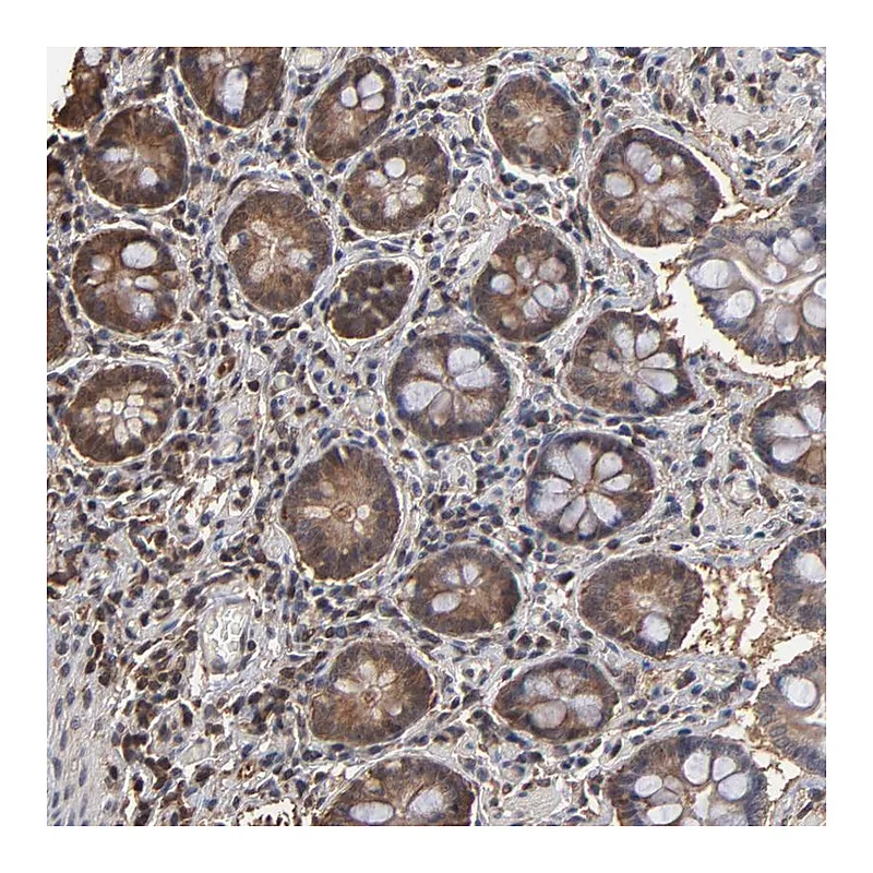 Atlas Antibodies Anti-PNPLA4 Antibody