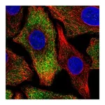 Atlas Antibodies Anti-PNPLA6 Antibody