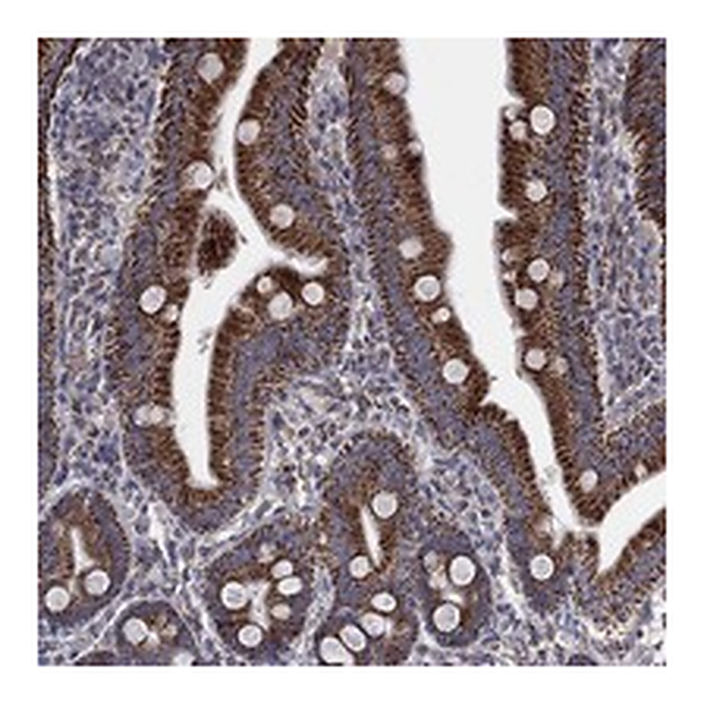 Atlas Antibodies Anti-PNPLA2 Antibody