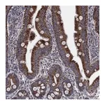 Atlas Antibodies Anti-PNPLA2 Antibody