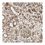 Atlas Antibodies Anti-PNPLA6 Antibody