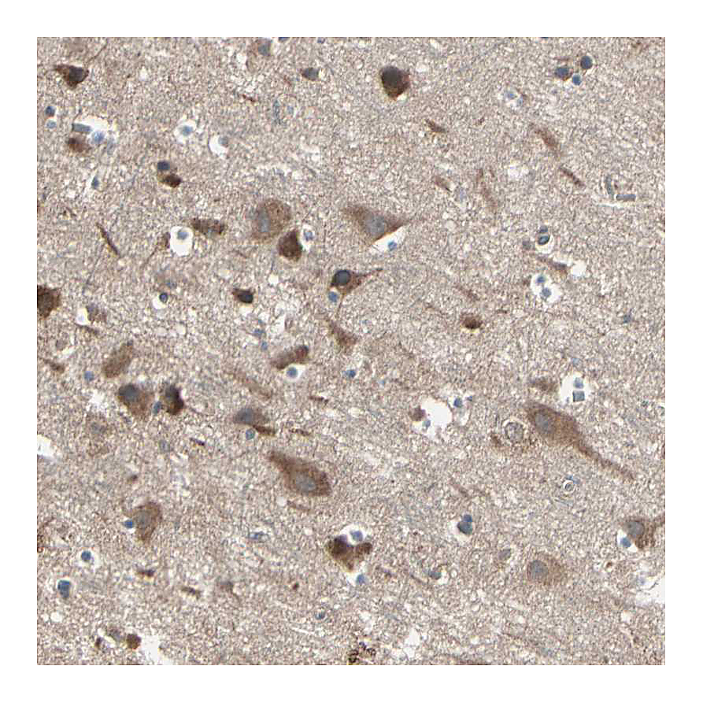 Atlas Antibodies Anti-PNPLA7 Antibody