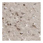 Atlas Antibodies Anti-PNPLA7 Antibody