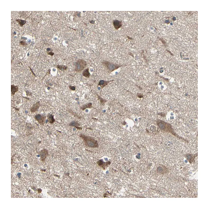 Atlas Antibodies Anti-PNPLA7 Antibody