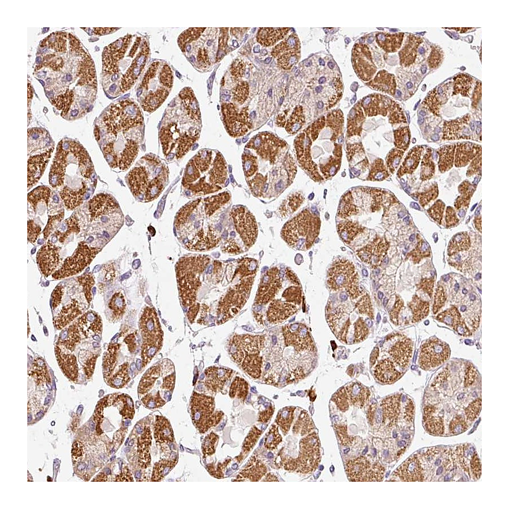 Atlas Antibodies Anti-PNPLA5 Antibody