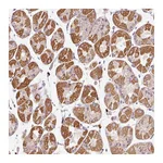 Atlas Antibodies Anti-PNPLA5 Antibody