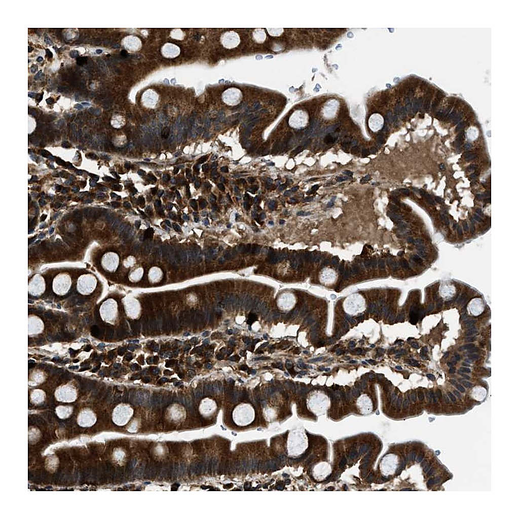 Atlas Antibodies Anti-PNPLA8 Antibody