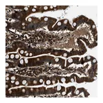 Atlas Antibodies Anti-PNPLA8 Antibody