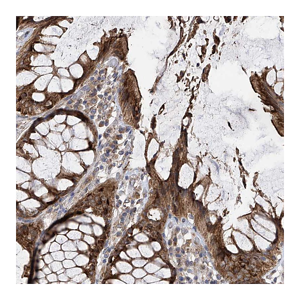 Atlas Antibodies Anti-PNPT1 Antibody