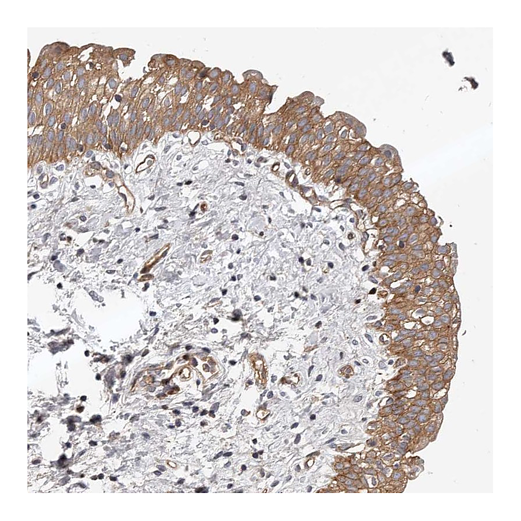 Atlas Antibodies Anti-PNRC2 Antibody