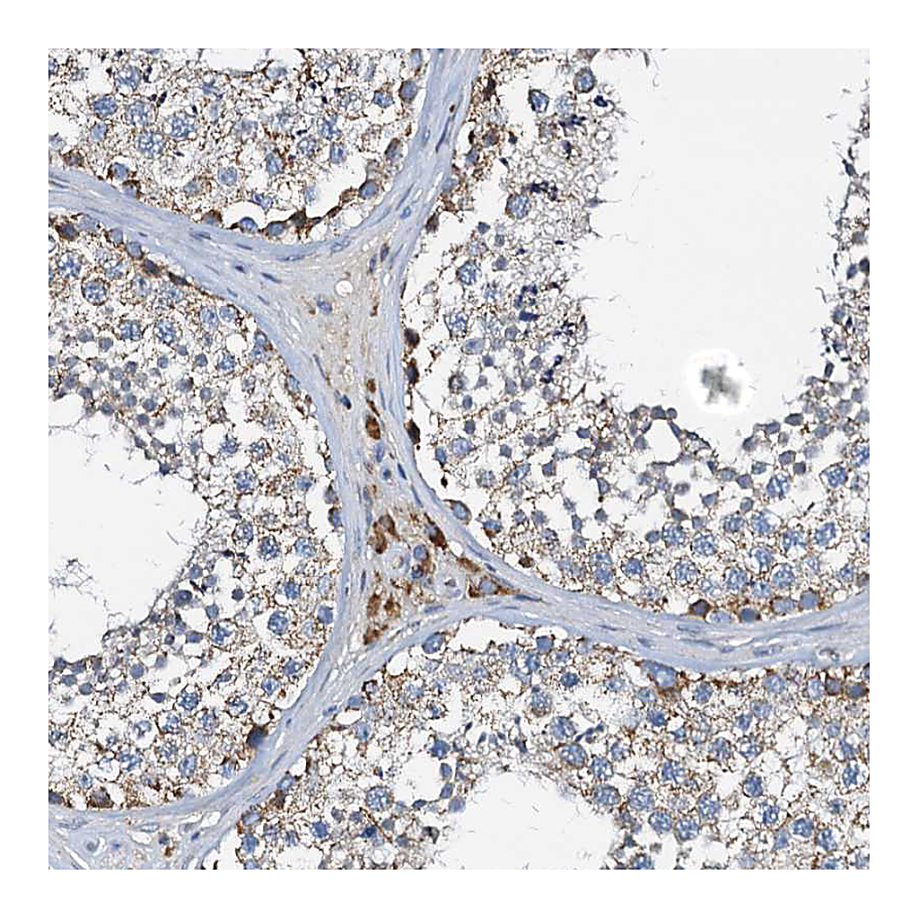 Atlas Antibodies Anti-POC1A Antibody