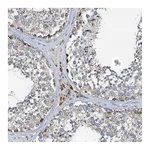 Atlas Antibodies Anti-POC1A Antibody