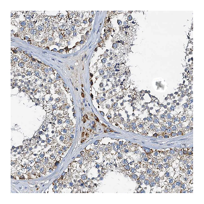 Atlas Antibodies Anti-POC1A Antibody