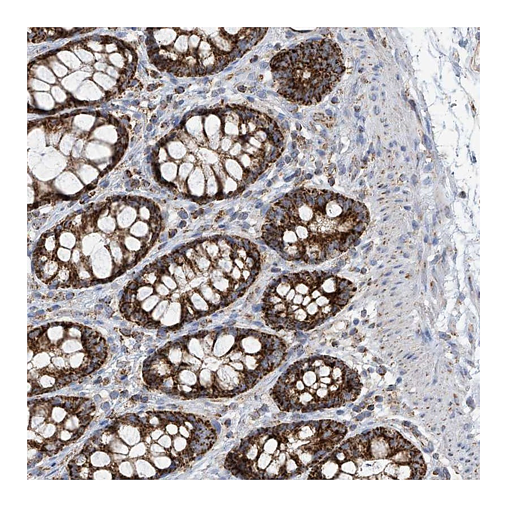 Atlas Antibodies Anti-PNPT1 Antibody